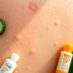Przebarwienia po peelingu chemicznym: najlepsze składniki, SPF i nawyki, które robią różnicę