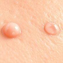 Zaskórniki otwarte a zamknięte: rutyna, która działa – bez przesuszenia i „agresji”