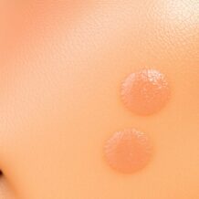 Dlaczego przebarwienia wracają: najlepsze składniki, SPF i nawyki, które robią różnicę