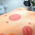 Kiedy do dermatologa z przebarwieniami? Zasady stosowania i sygnały, że to dobry moment