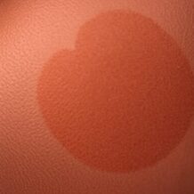 Rebound hyperpigmentation: proste wyjaśnienie, zastosowania i kiedy uważać